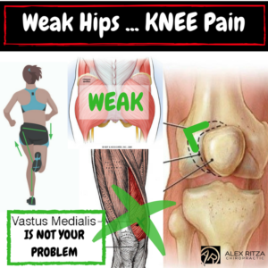 Dr Alex Ritza | Knee Pain | Runners Knee | Downtown Toronto Chiropractor