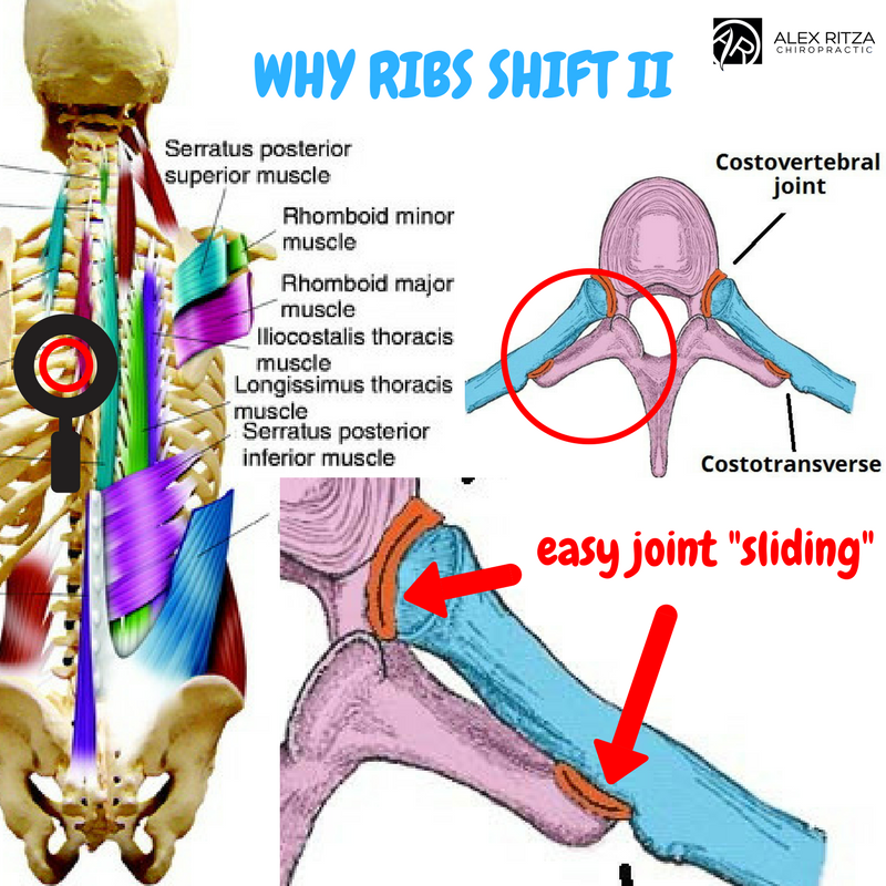 Rib Pain | Dr Alex Ritza | Downtown Toronto Chiropractor