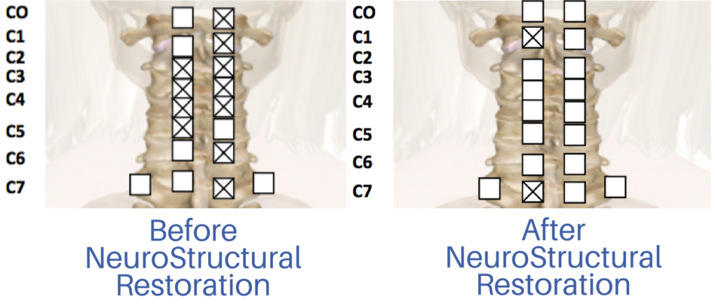 Headache Treatment Toronto | Downtown Toronto Chiropractor | Dr Alex Ritza