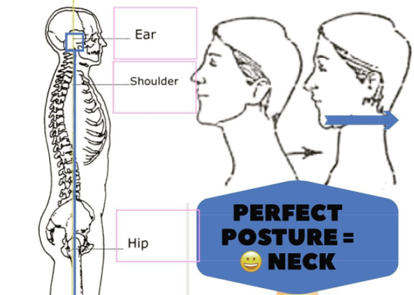 Downtown Toronto Chiropractor Dr Ritza's Chin Tuck for Perfect Lifts