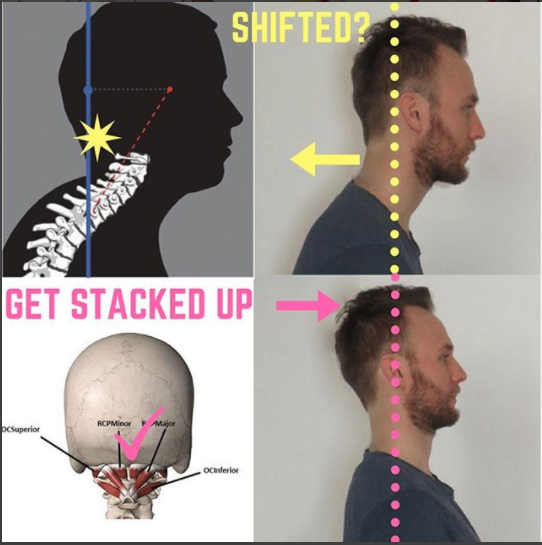 ARE you shifted | Dr Alex Ritza | Downtown Toronto Chiropractor