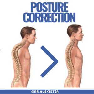 Improve My Posture Dr Alex Ritza Toronto Best Chiropractor