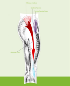 Best hip bursitis treatment Toronto | Dr Alex Ritza