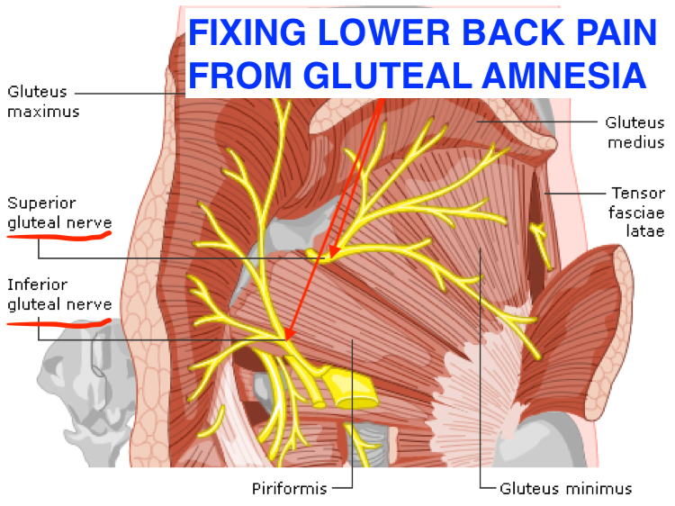 Lower back pain relief in Toronto | Dr Alex Ritza | What is gluteal amnesia