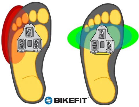 When to use wedges in cycling shoes | Toronto Bike Fit