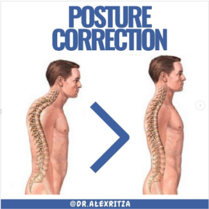 Posture Treatment Toronto | Dr Alex Ritza