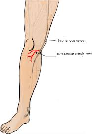 Best innner knee pain treatment toronto | Saphenous Nerve entrapment