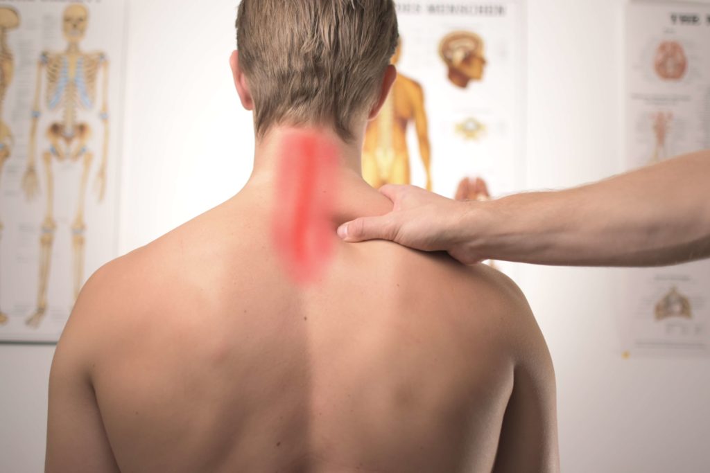 Neck Hump Fix Toronto | Kyphosis Treatment Toronto