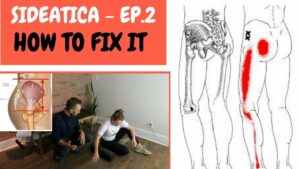 Outer Hip AND Thigh Pain Treatment Toronto | Sideactica Treatment Toronto