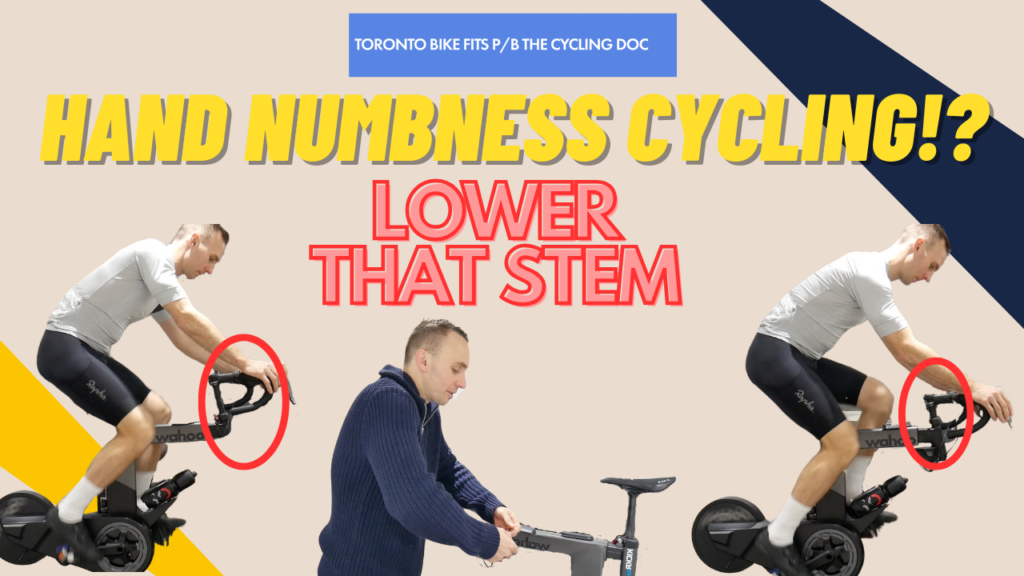 Fix Hand Numbness Cycling | Reduce Finger Numbness with Bike Fit